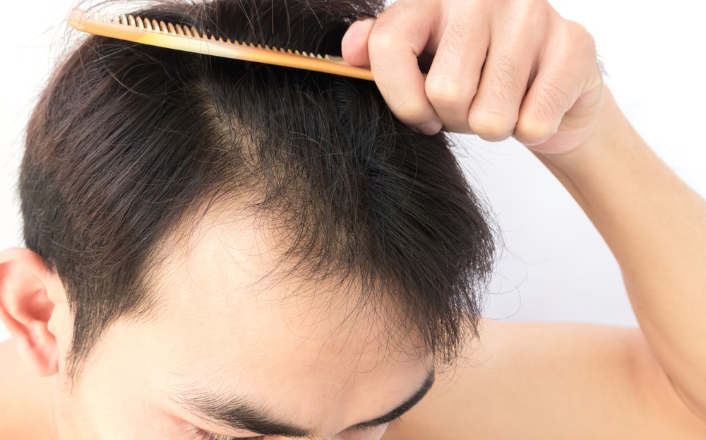 Tips to Fix Your Hair Fall Problem in A Hassle-Free Manner