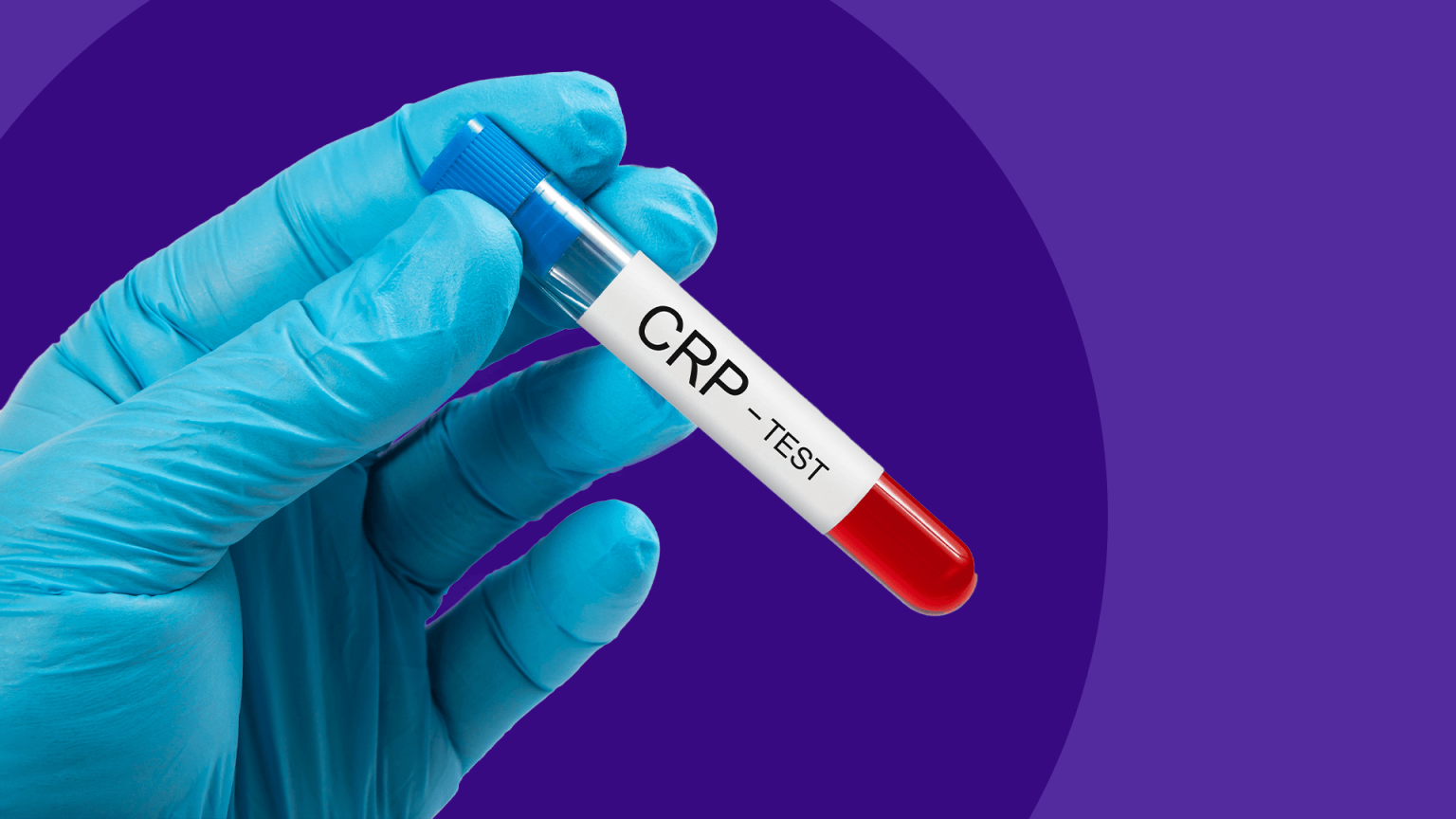 crp-blood-test-blood-test-for-c-reactive-protein