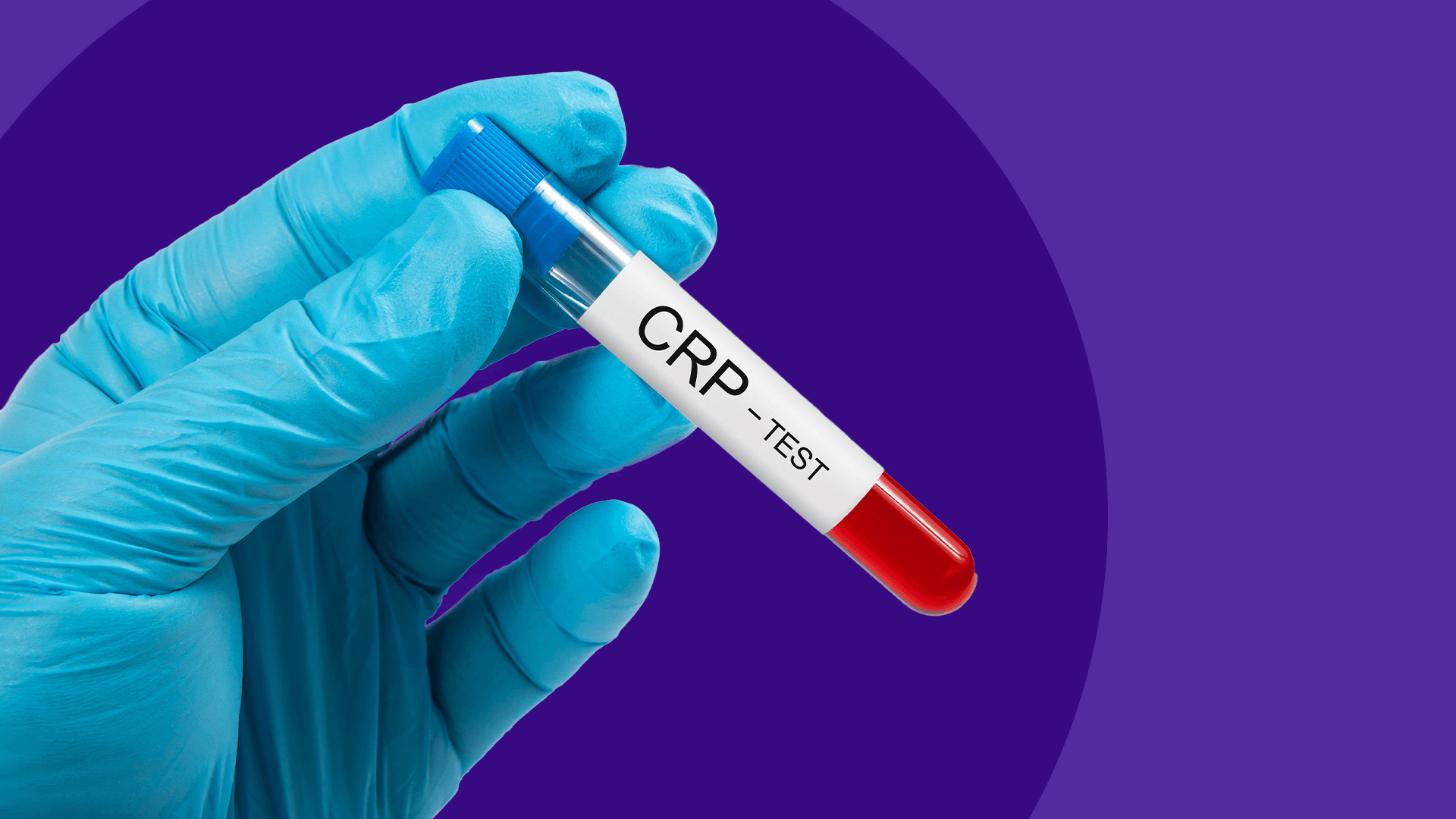 know-how-to-interpret-c-reactive-protein-crp-test-results-news-ch